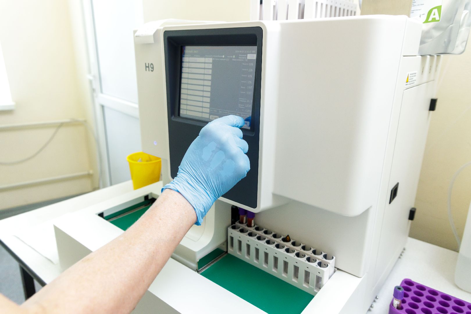 Люберцы, Люберецкая областная больница, лаборатория,