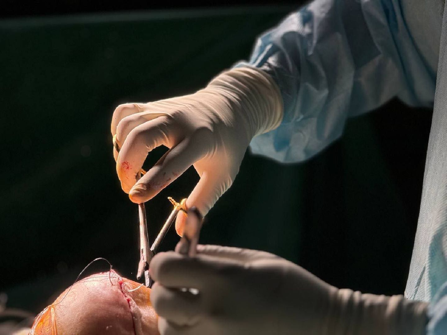 день открытых дверей, Центр травматологи и ортопедии, жуковская окб, Лилия Бусыгина, эдуард семенов, эндопротезирование, суставы,