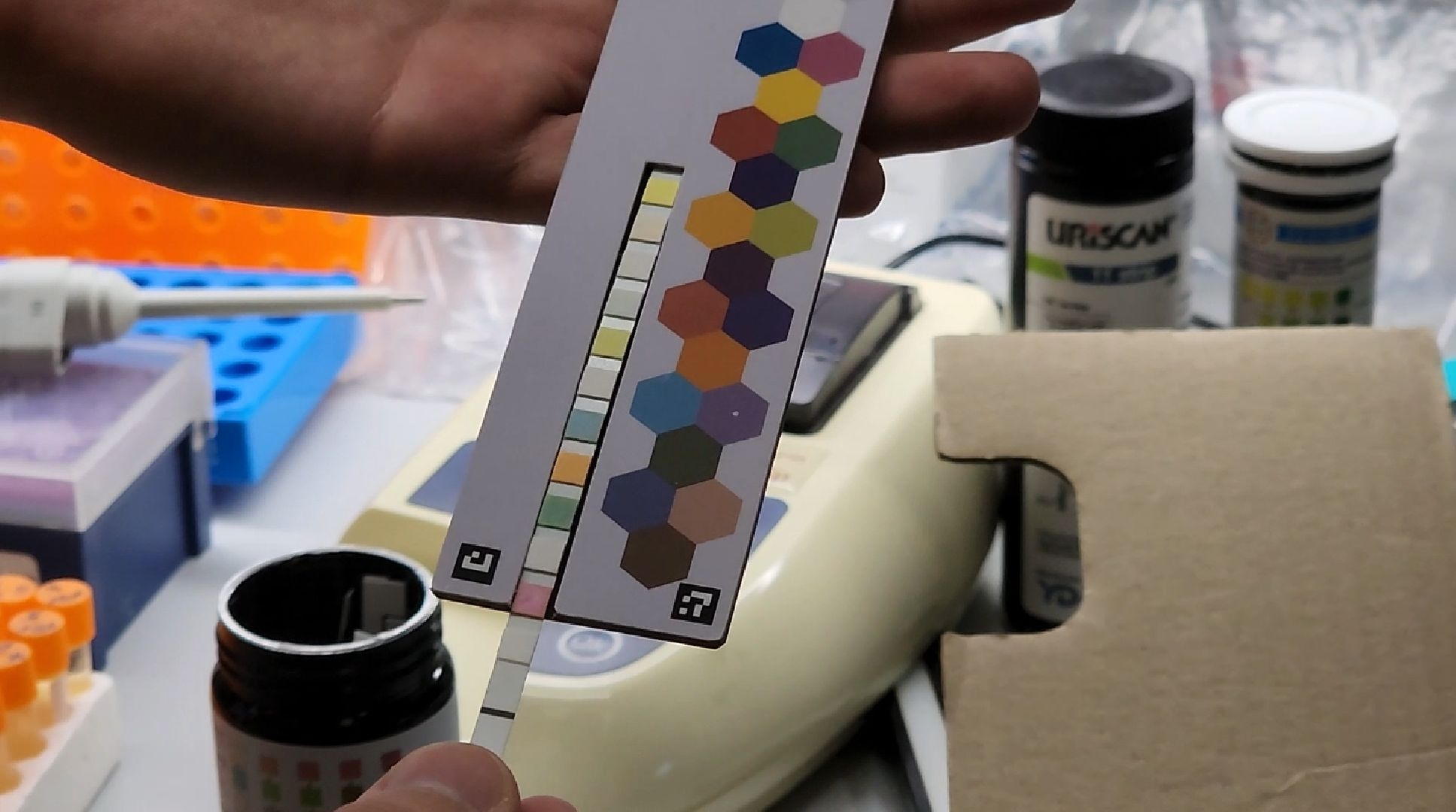 долгопрудный, мфти, студенческий стартап, анализ мочи,