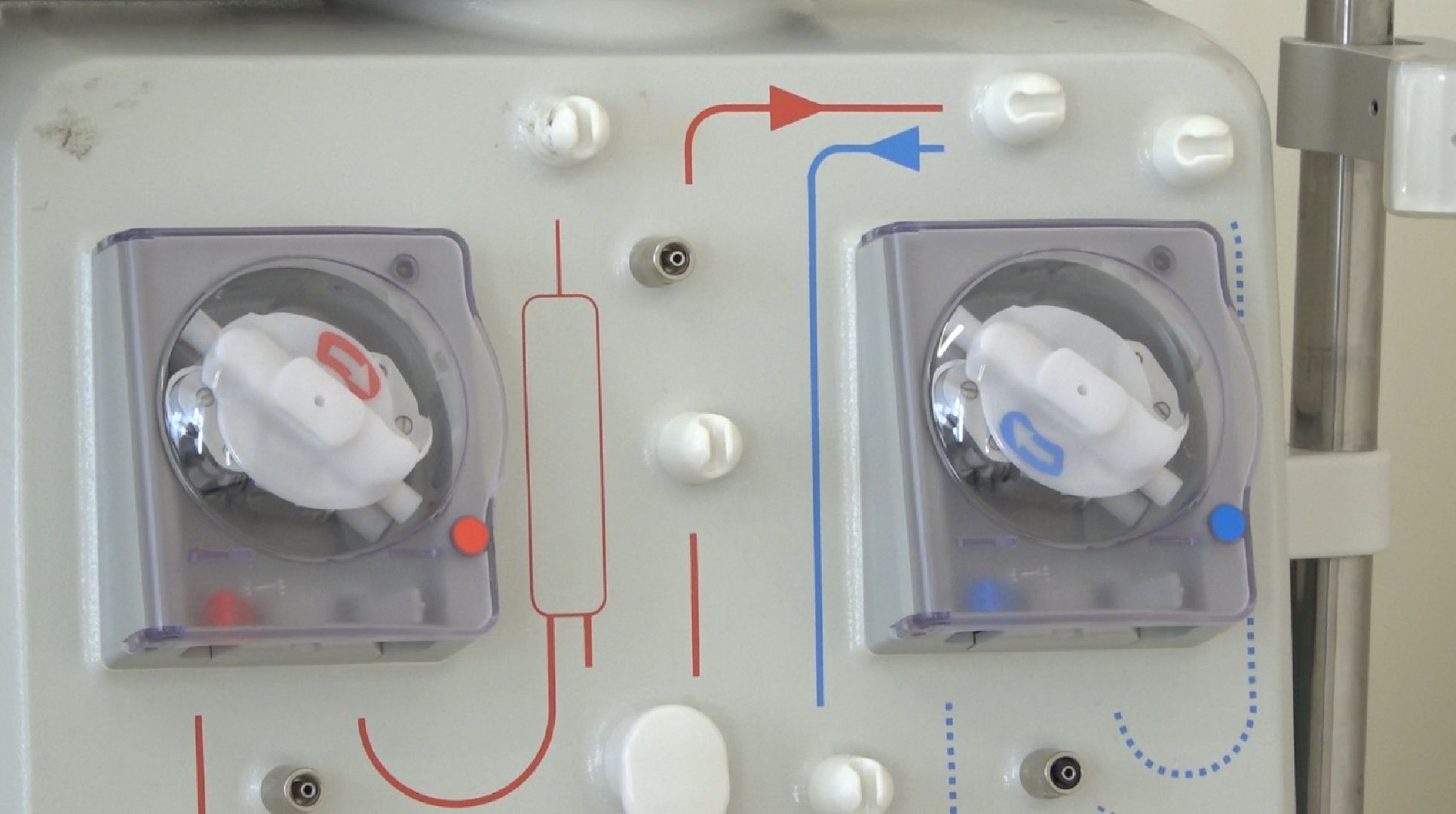 Домодедовская больница, диализ, почечная недостаточность