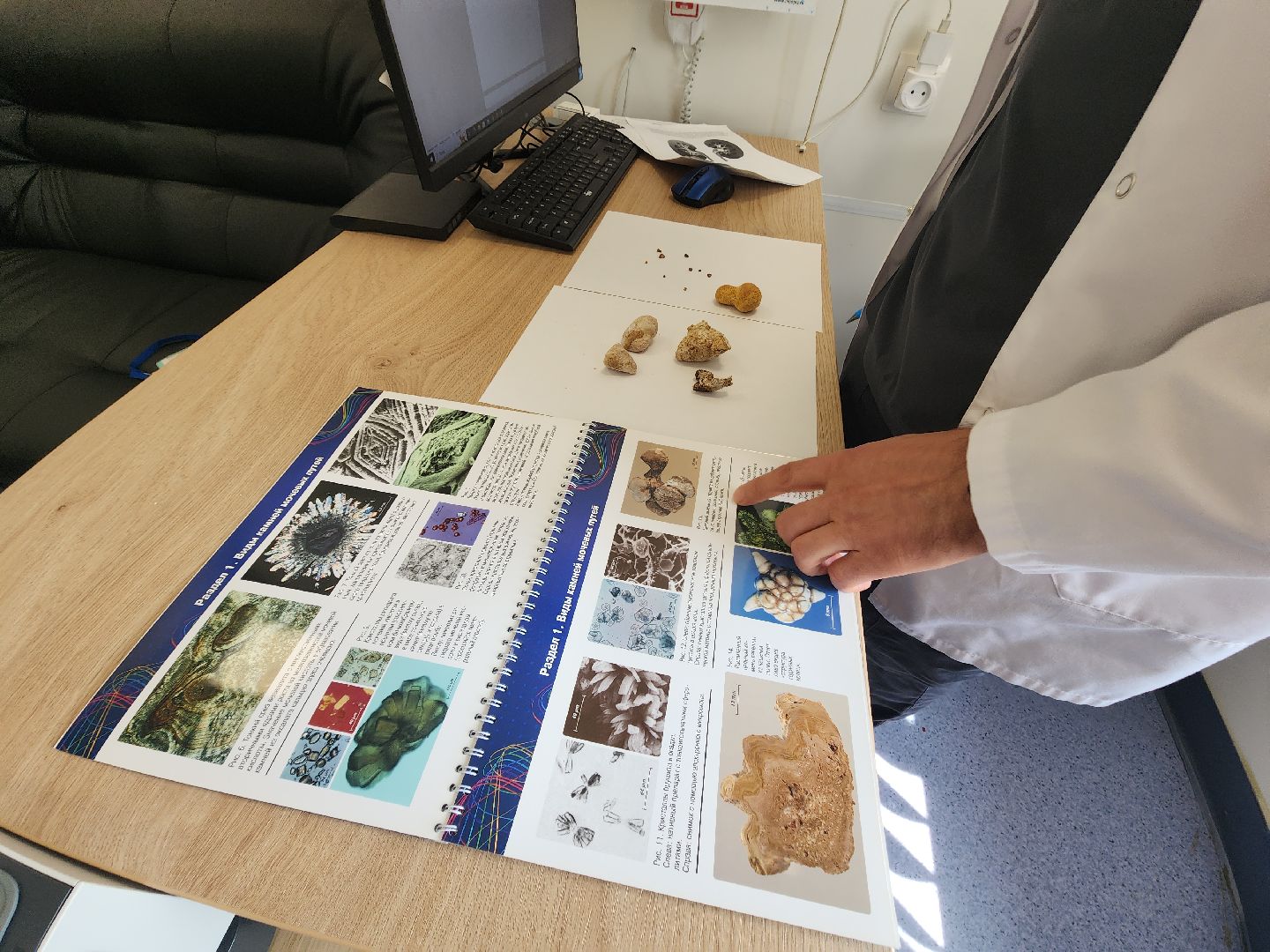 урология, камни в почках, профилактика болезней, советы врачей,