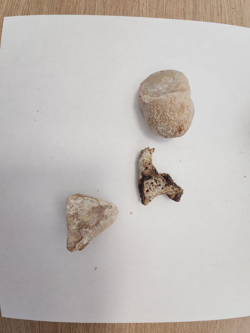 урология, камни в почках, профилактика болезней, советы врачей,