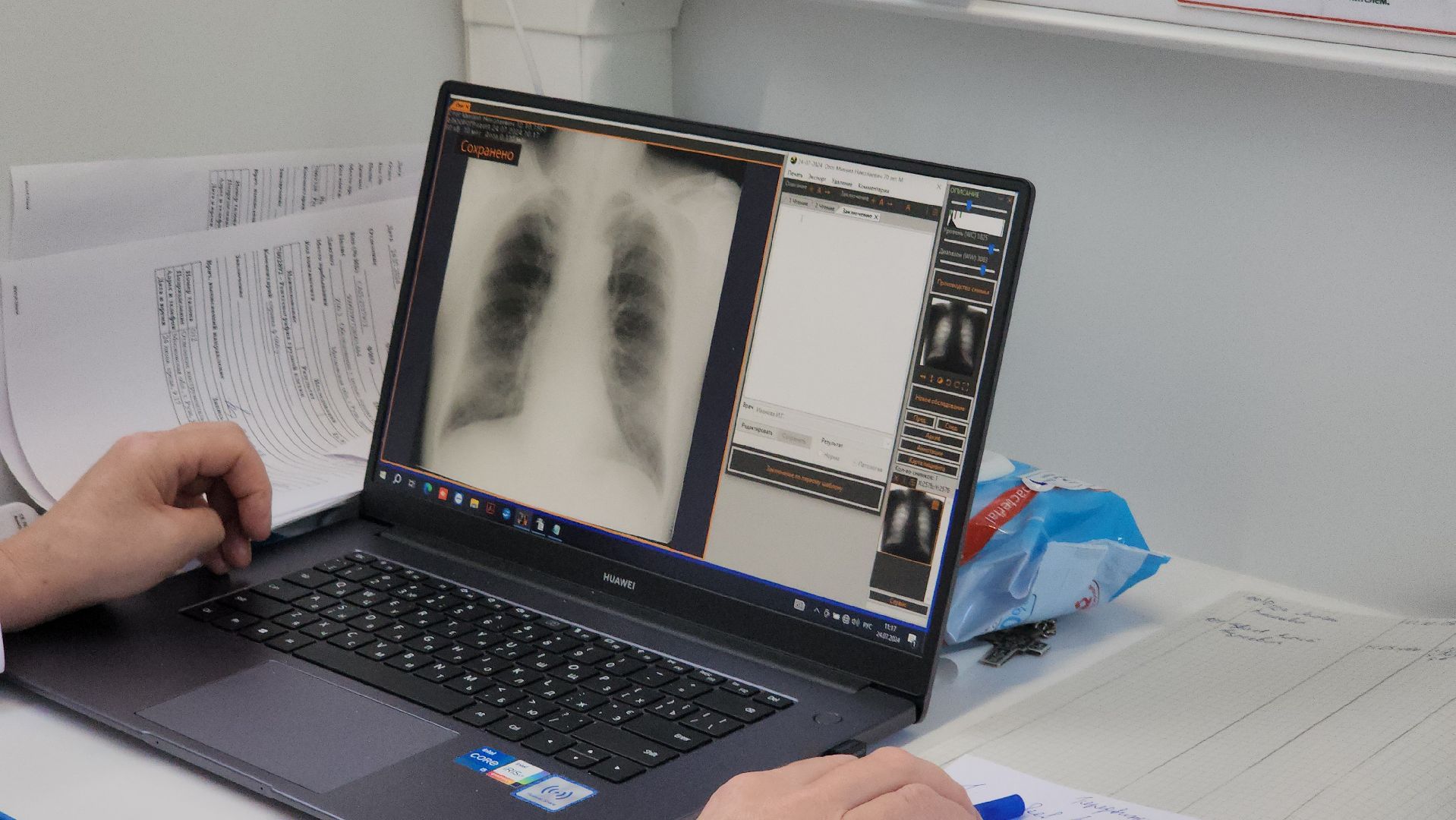 медицина подмосковья, новое медоборудование, рузская больница, руза, здравоохранение, здравоохранение мо, здравоохранение московской области,