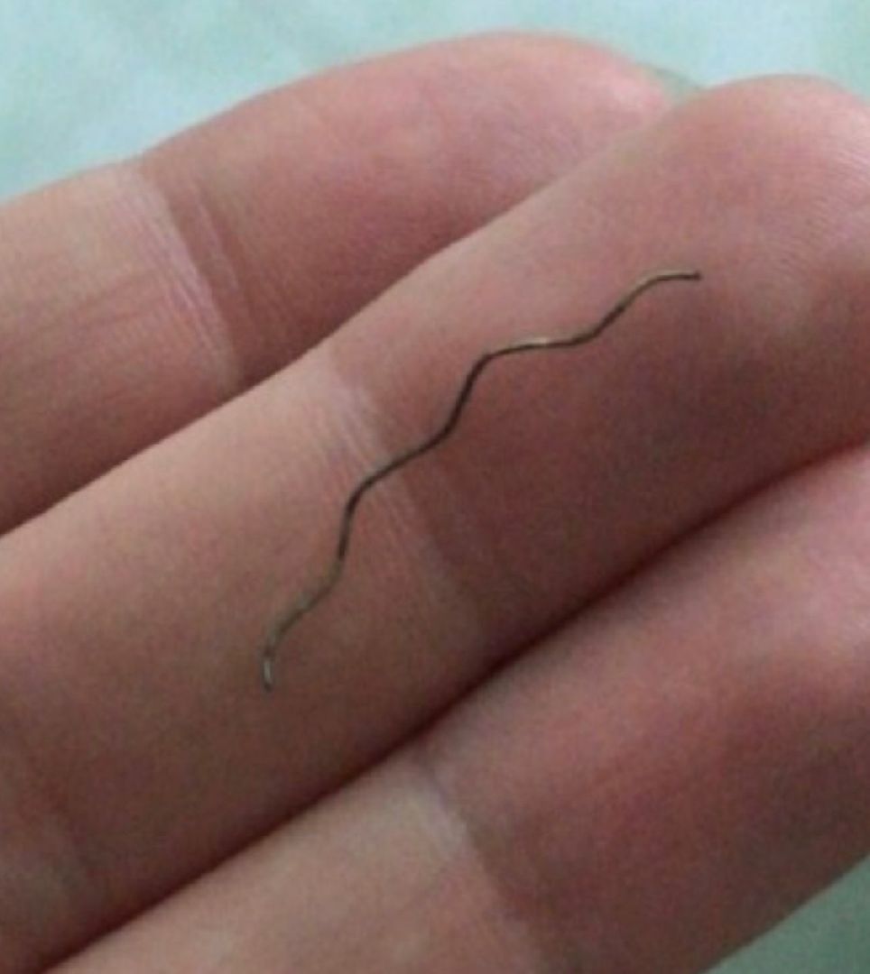 травмы, врачи, зрение, уникальный случай,