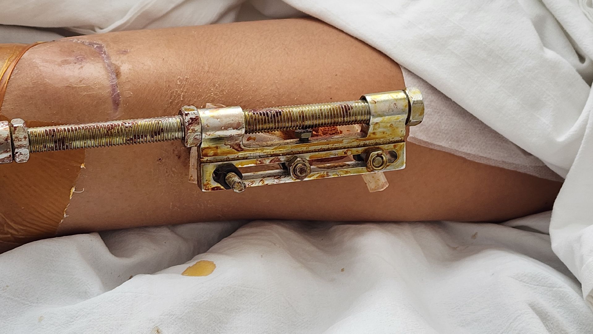 Солнечногорск, медицина, травматология, ДТП,