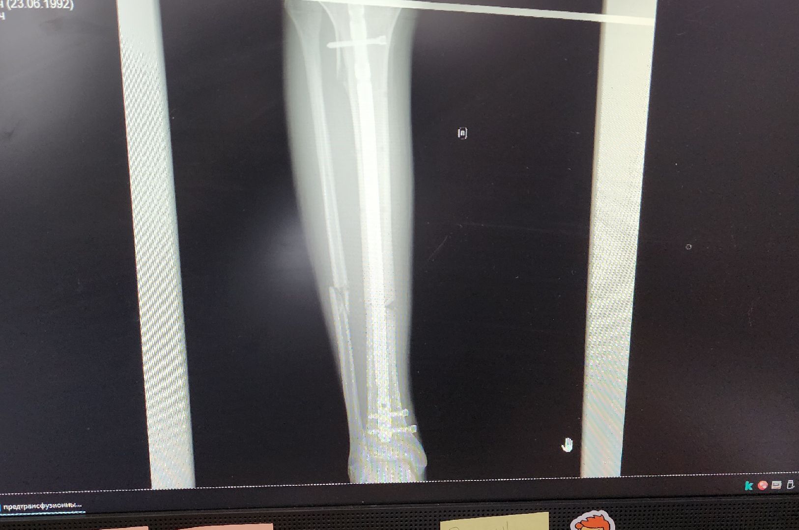 Солнечногорск, медицина, травматология, ДТП,