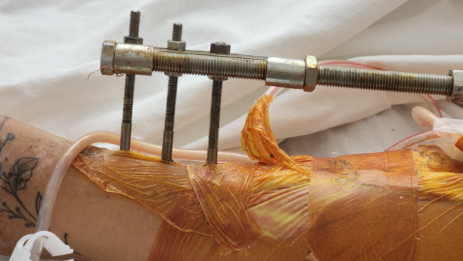 Солнечногорск, медицина, травматология, ДТП,