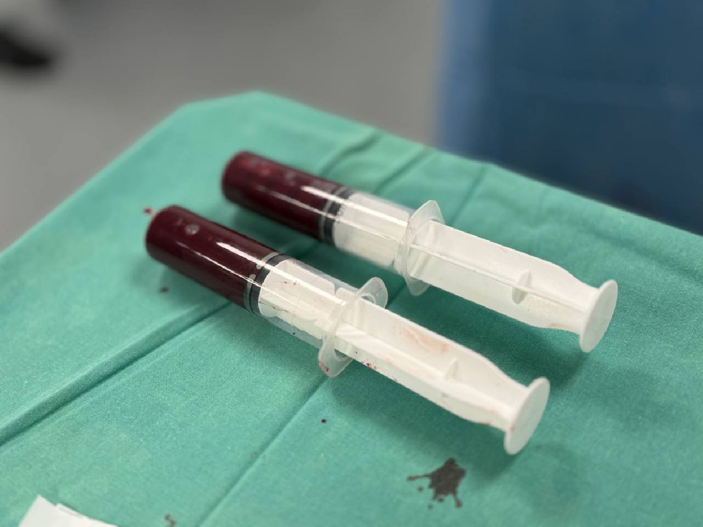 Жуковская ОКБ, травматология, центр травматологи и ортопедии, BMAC-терапия, Бимак, Артем Луценко, костный мозг,