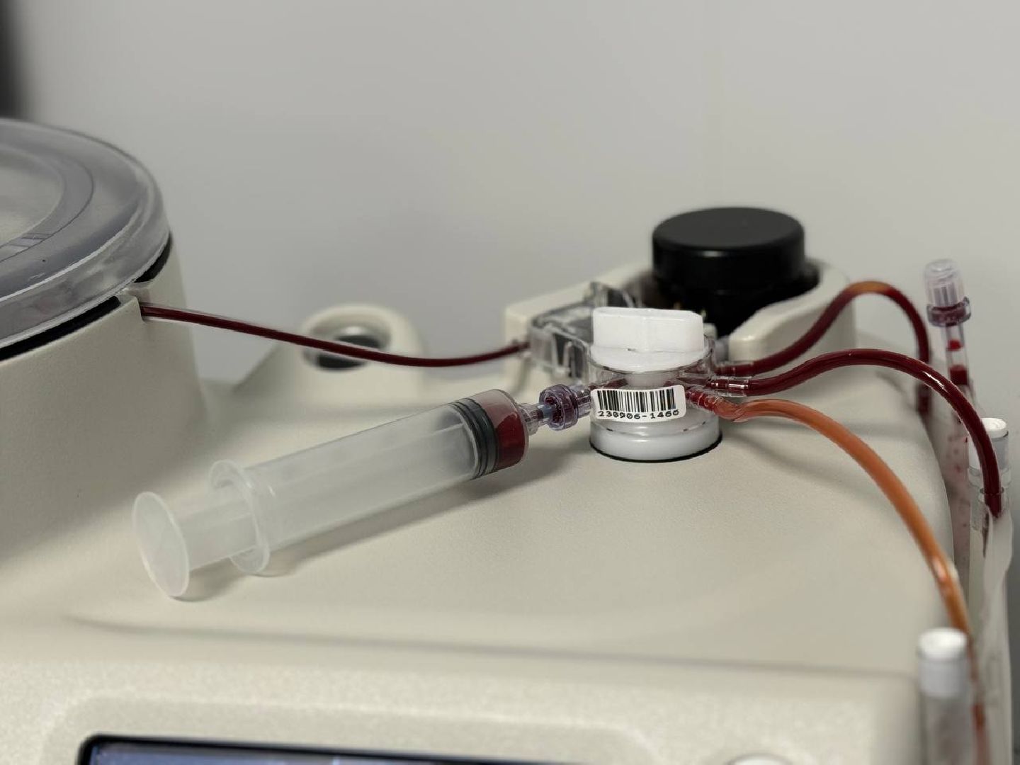 Жуковская ОКБ, травматология, центр травматологи и ортопедии, BMAC-терапия, Бимак, Артем Луценко, костный мозг,