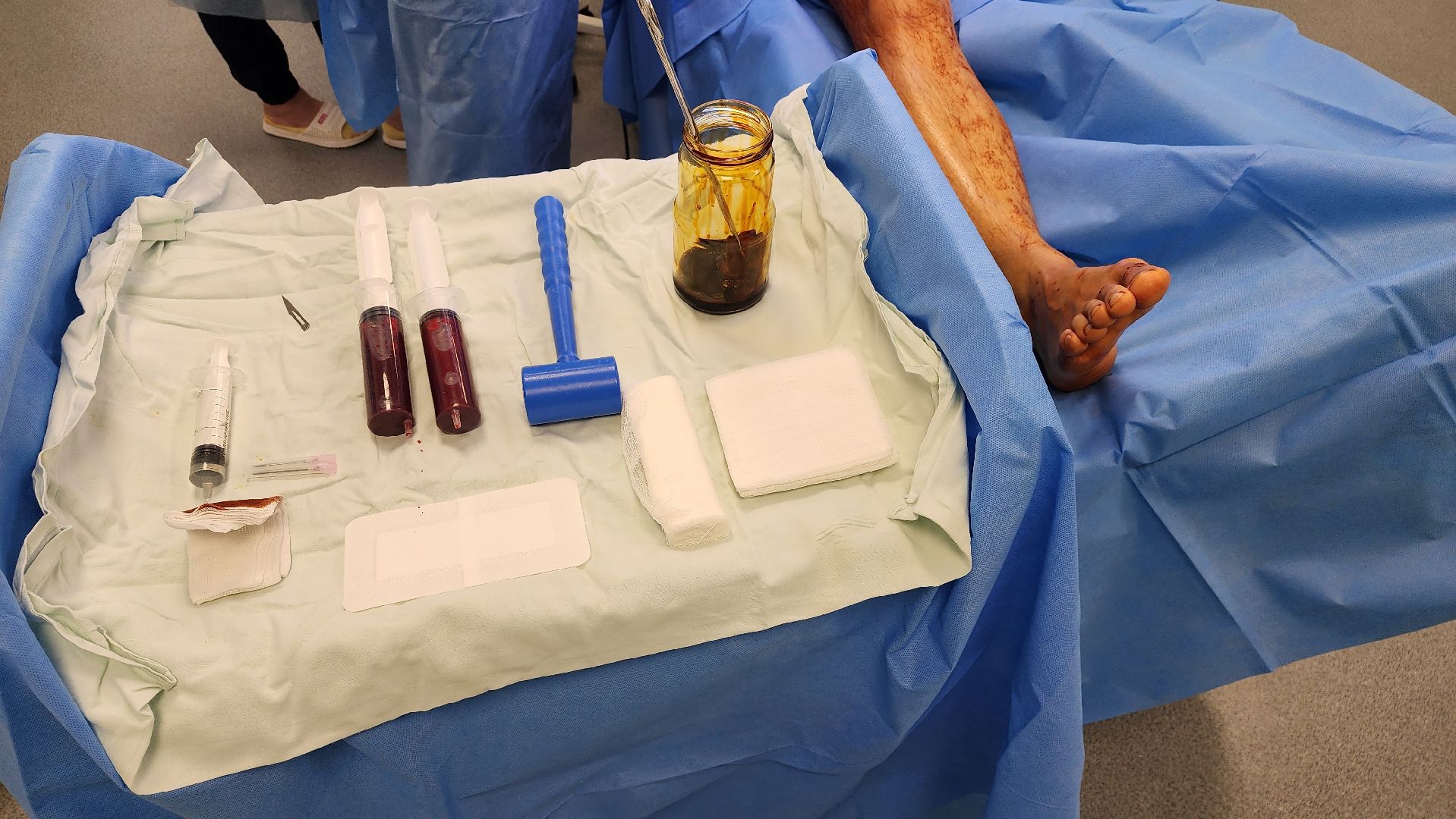 Жуковская ОКБ, травматология, центр травматологи и ортопедии, BMAC-терапия, Бимак, Артем Луценко, костный мозг,