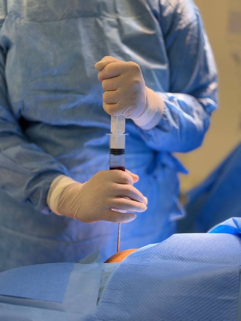 Жуковская ОКБ, травматология, центр травматологи и ортопедии, BMAC-терапия, Бимак, Артем Луценко, костный мозг,