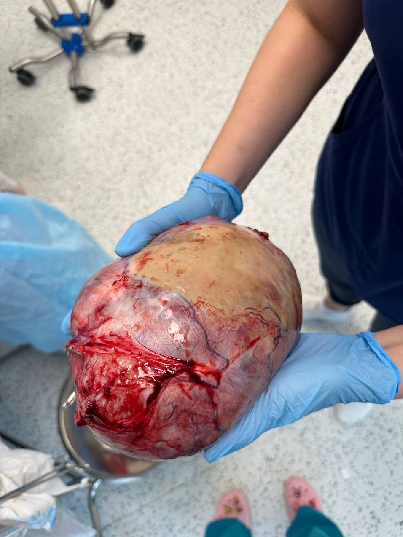 уникальная операция, гинекология,рекомендации врача,