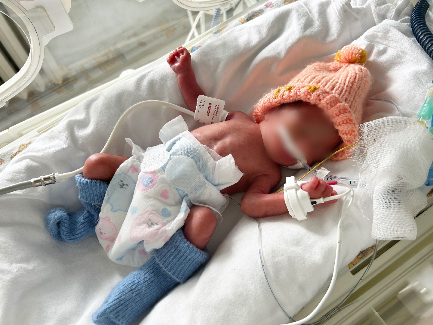 Солнечногорск, медицина, роддом, история спасения,