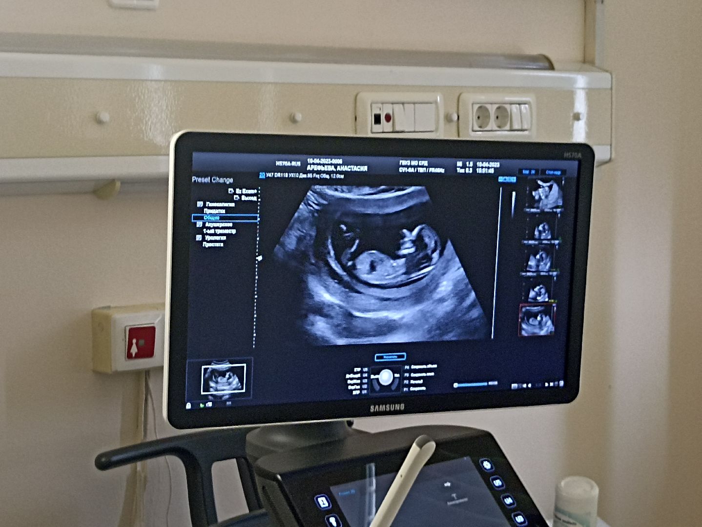 Серпухов, роддом, Подмосковье, оборудование, новорожденные,