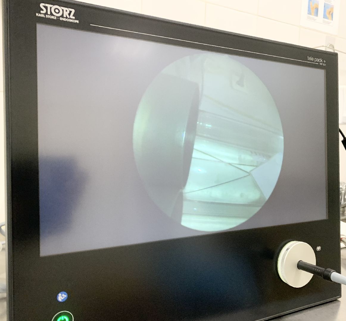 Балашиха, Подмосковье, балашихинская больница, цистоскоп, новое медоборудование,