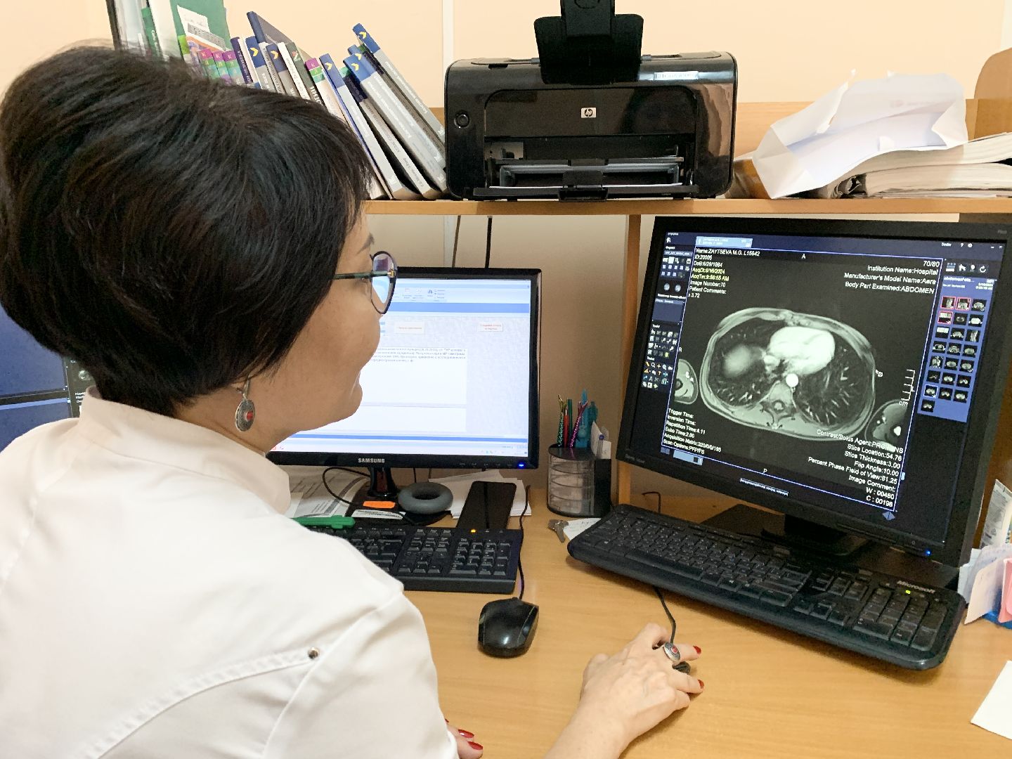 Балашиха, Подмосковье, МРТ, Инновационный препарат,московский областной онкологический диспансер, заболевания печени, Онкология, Рак,