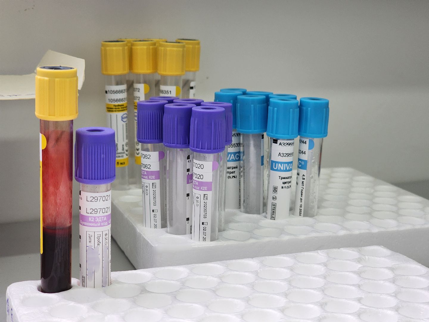 одинцово, профосмотр, медосмотр, проверка здоровья, мобильный пункт,