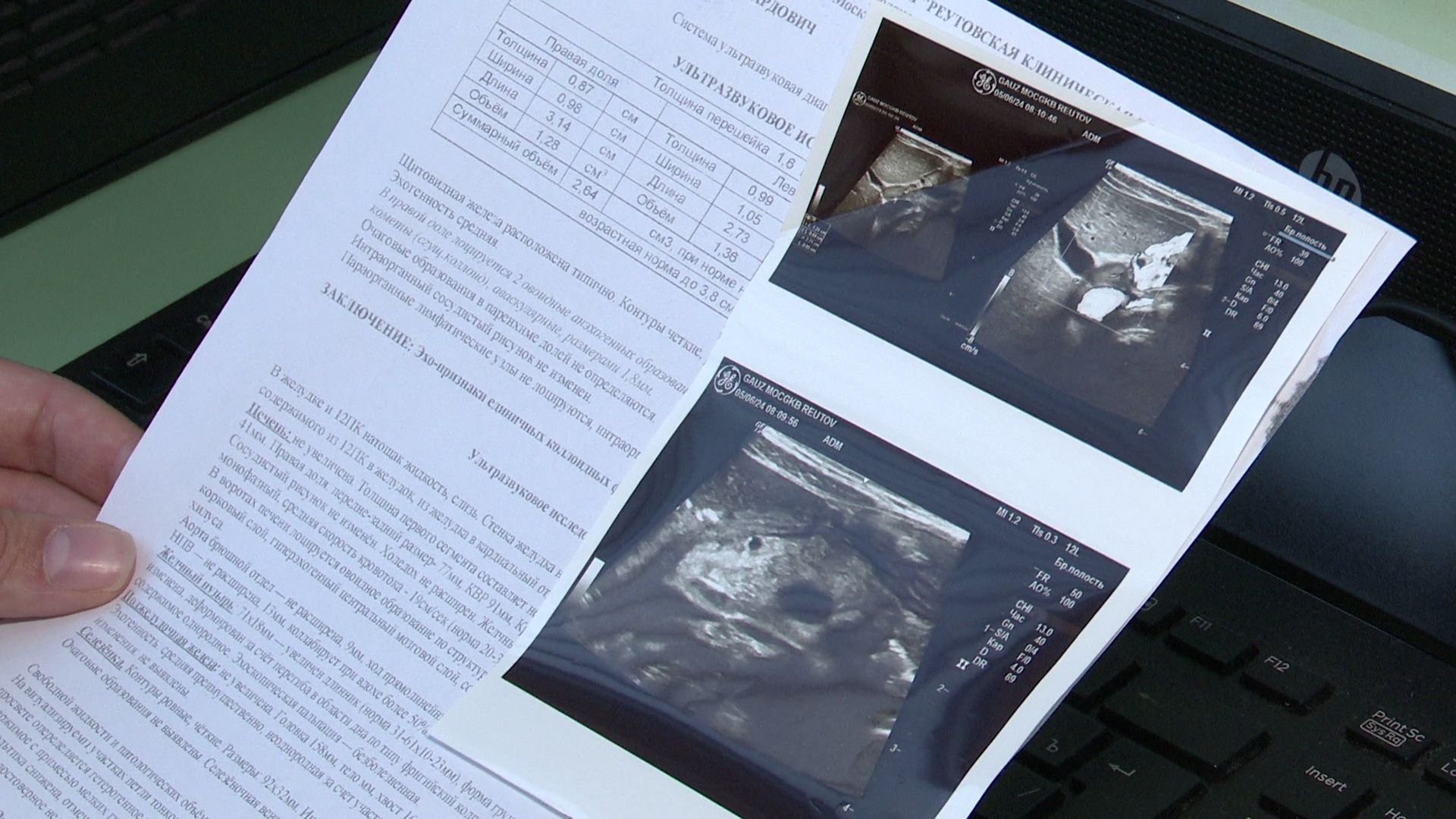 Реутов, медицина, врач, поддержка, социальная ипотека,