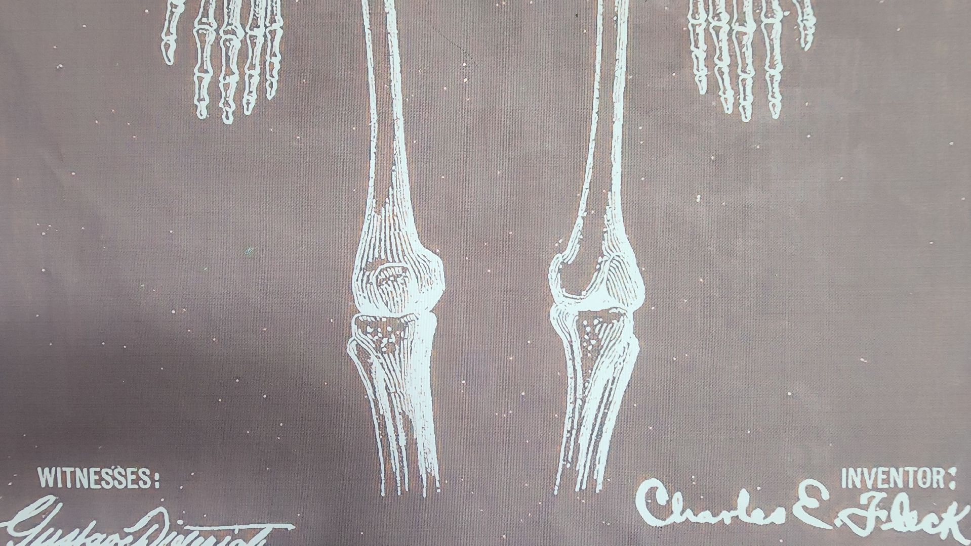 Солнечногорск, медицина, травматология, велосипед,
