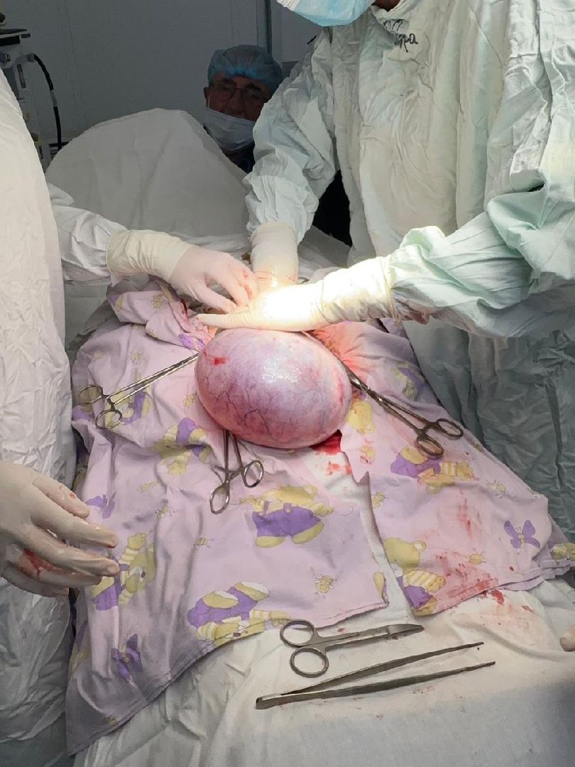 операции,советы врачей,