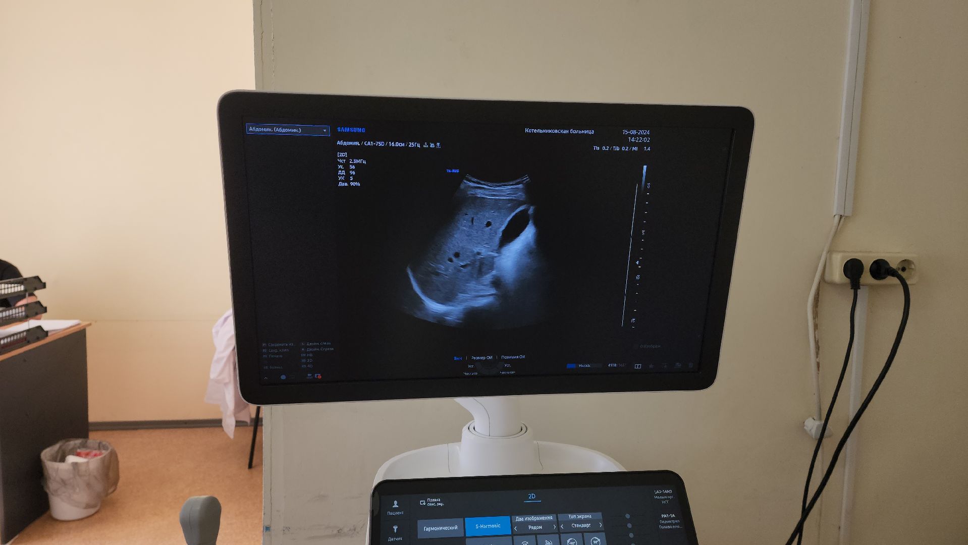 узи-диагностика, аппарат узи, новая медтехника, национальный проект,
