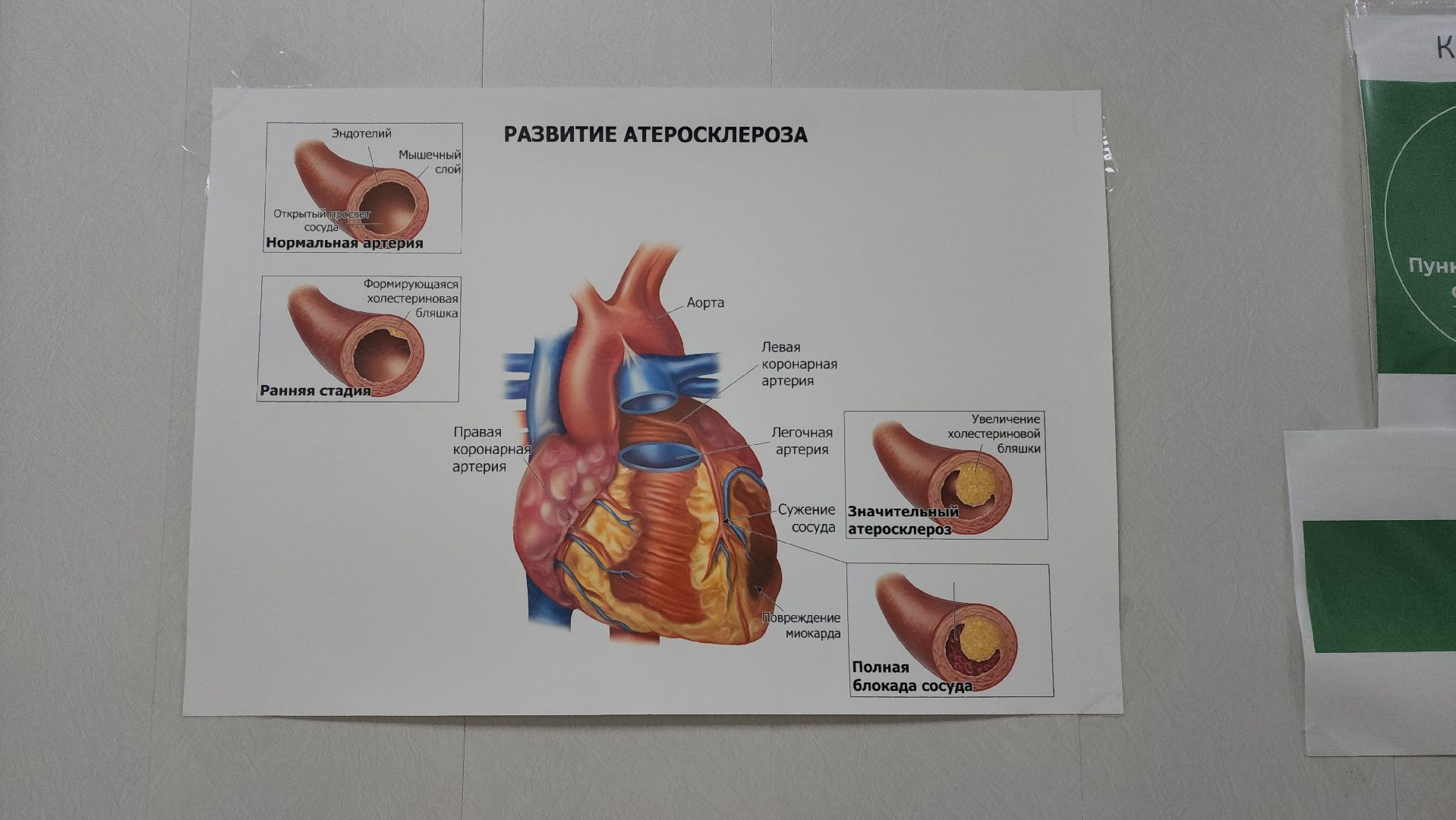 кардиолог, Лобня, профилактика, Сердце,
