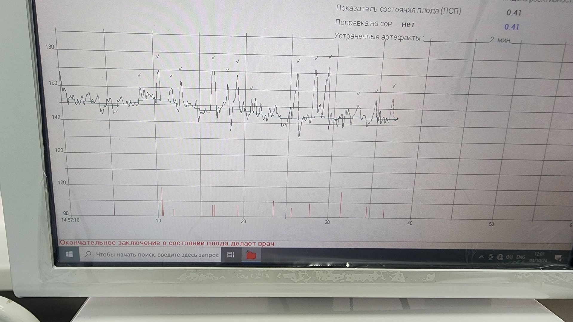 Солнечногорск, медицина, женская консультация, женщины, медицинское оборудование,