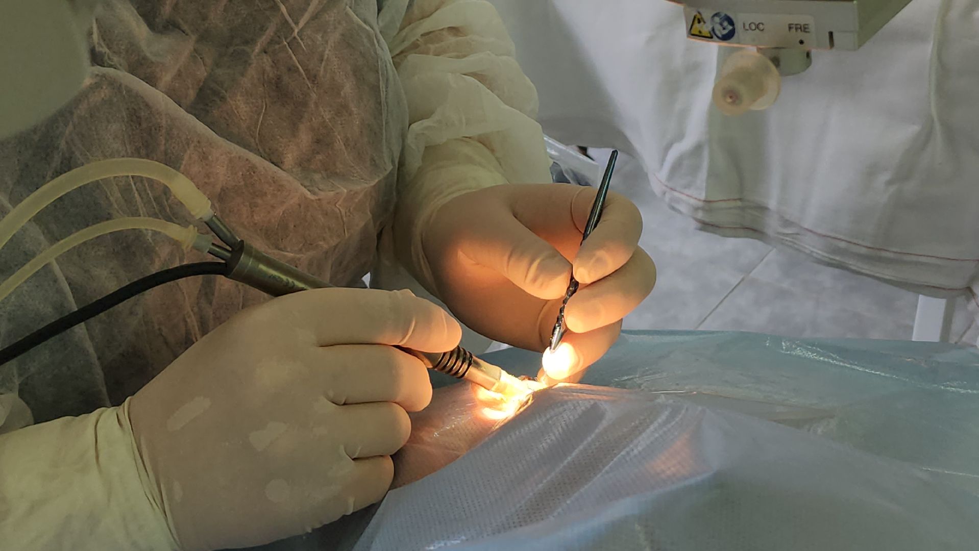 люберцы, люберецкая больница, офтальмолог, операции,