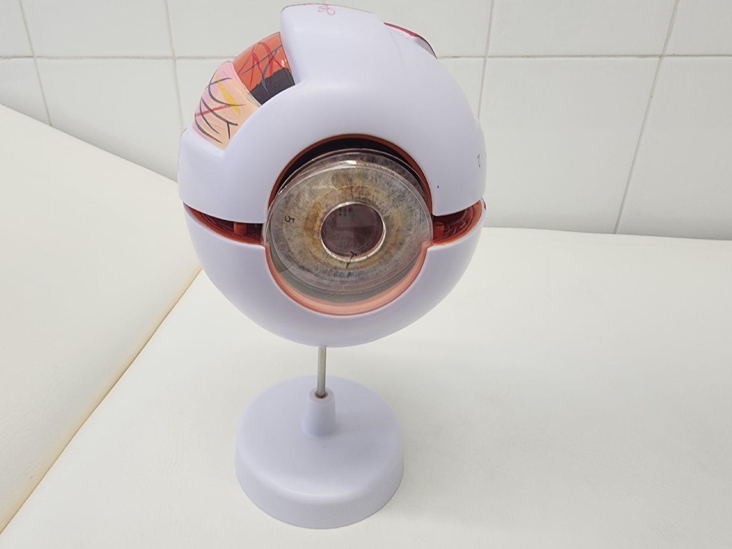 операции, офтальмология,