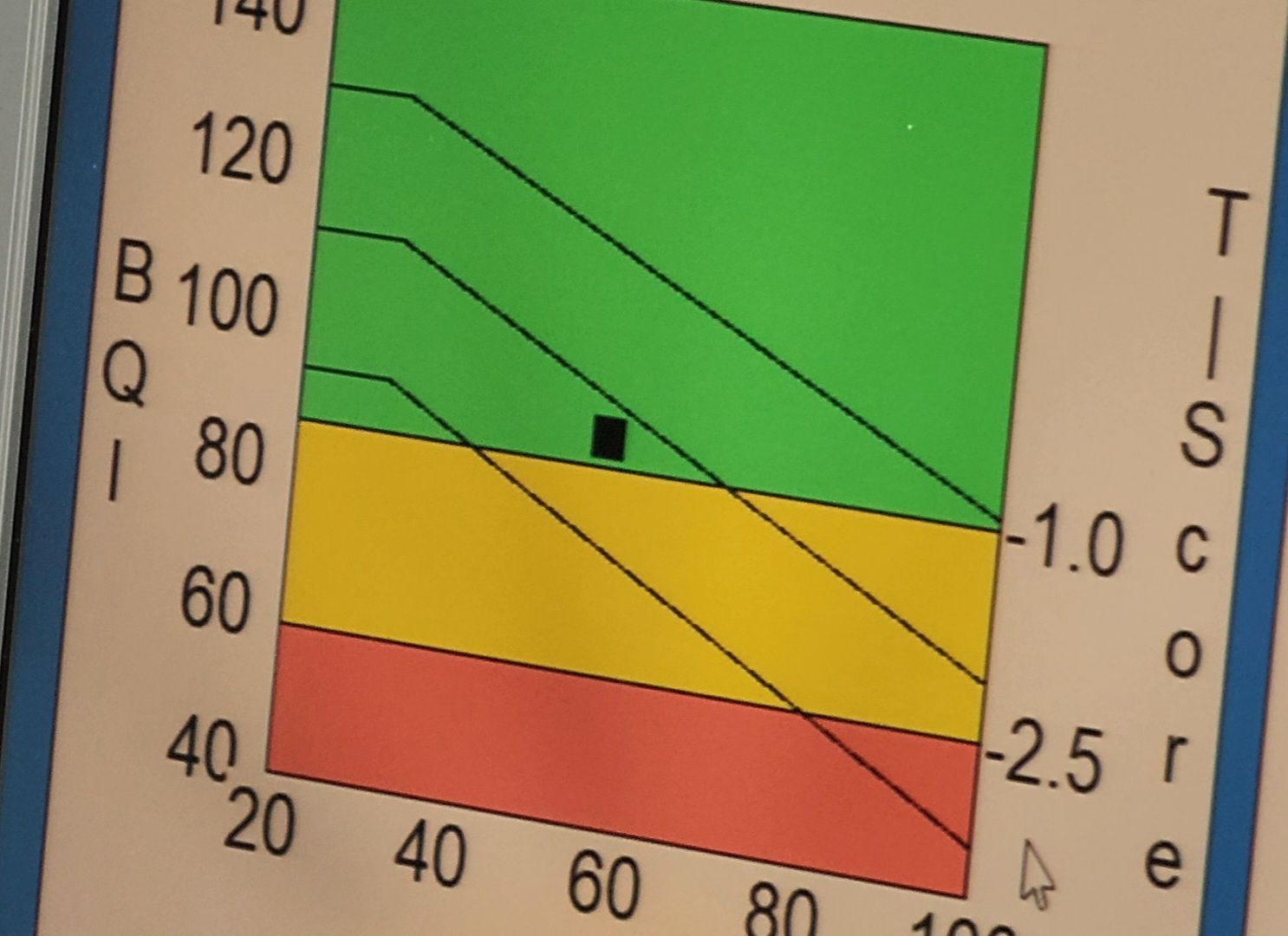 Дубна, дубненская больница, Талдомский округ, Денситометрия, Обследование,
