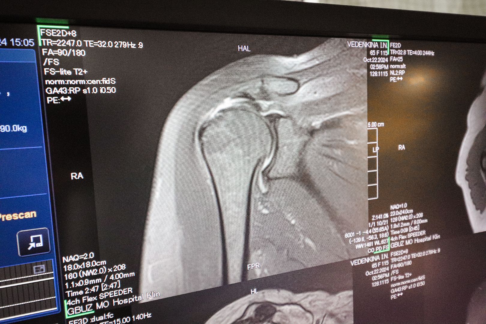 Клин, общество, медицина, новый аппарат МРТ,