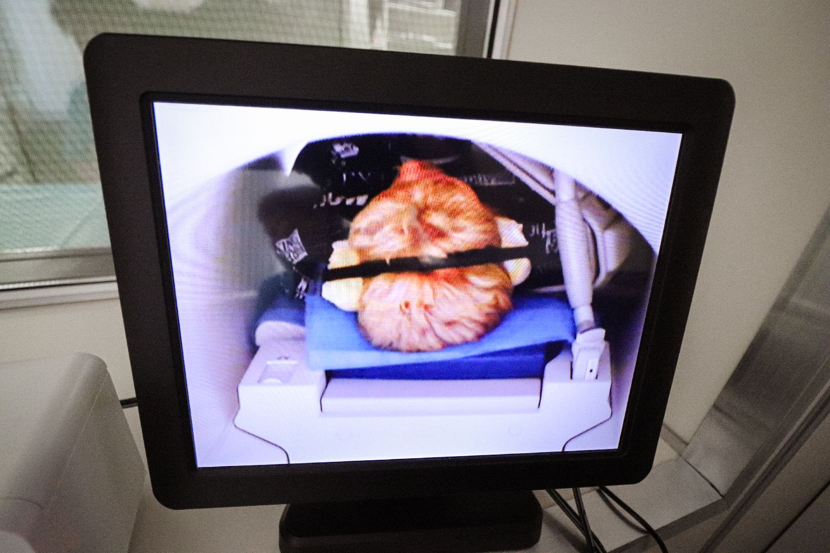 Клин, общество, медицина, новый аппарат МРТ,