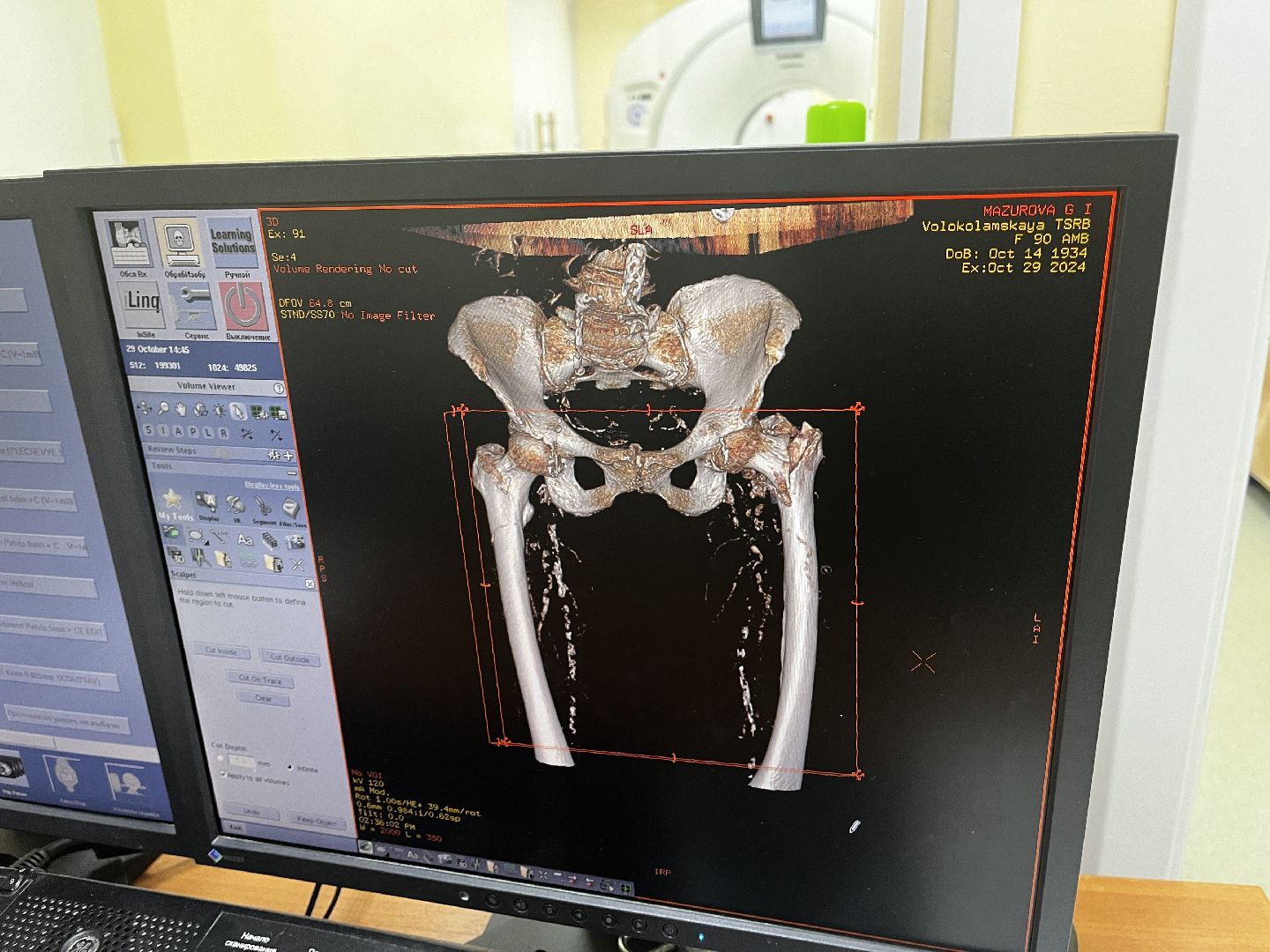 волоколамск, КТ, компьютерная томография, медицина,