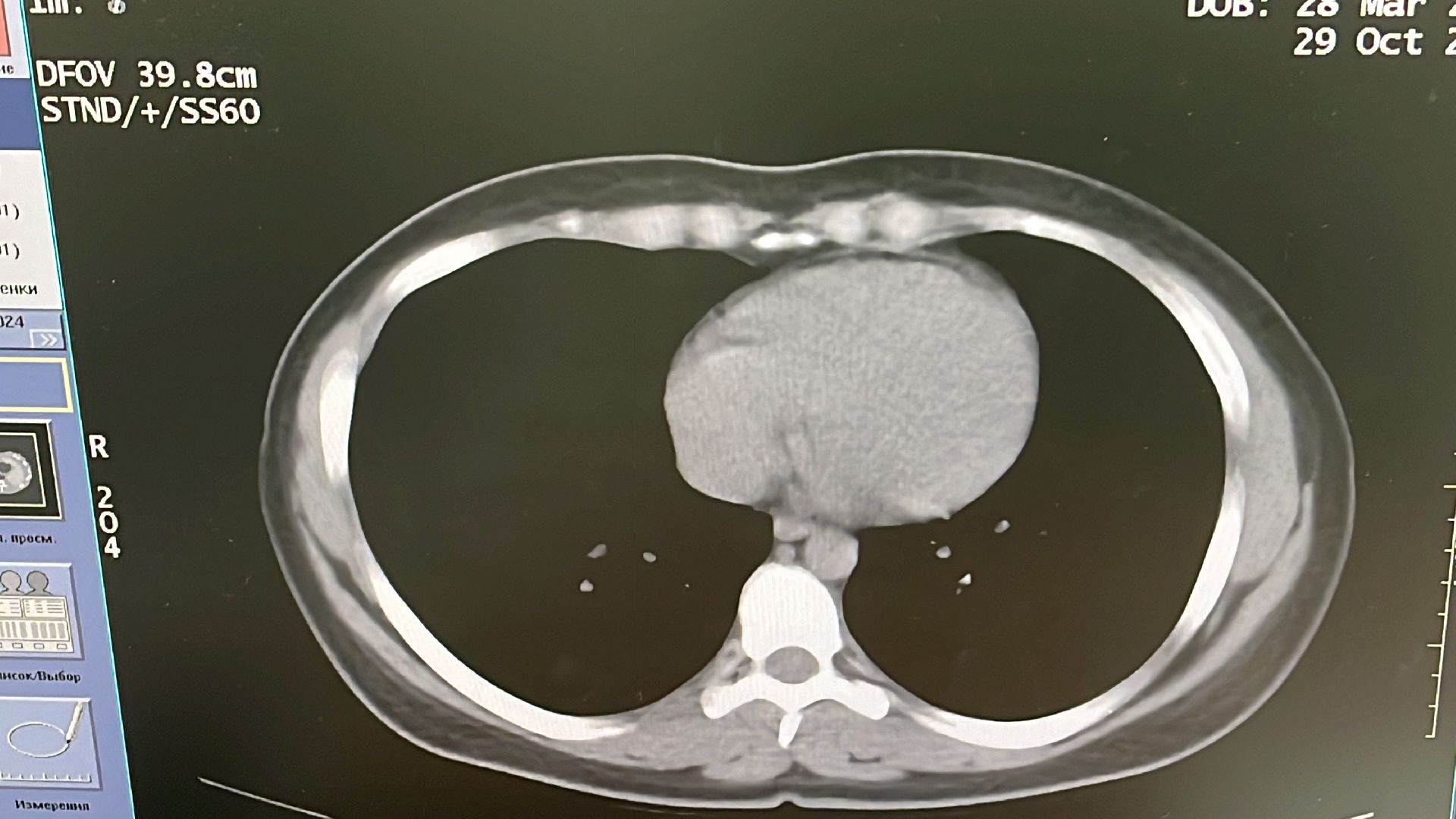 волоколамск, КТ, компьютерная томография, медицина,