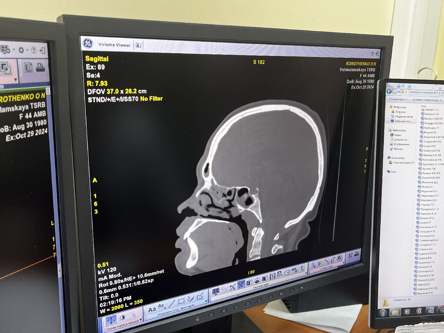 волоколамск, КТ, компьютерная томография, медицина,