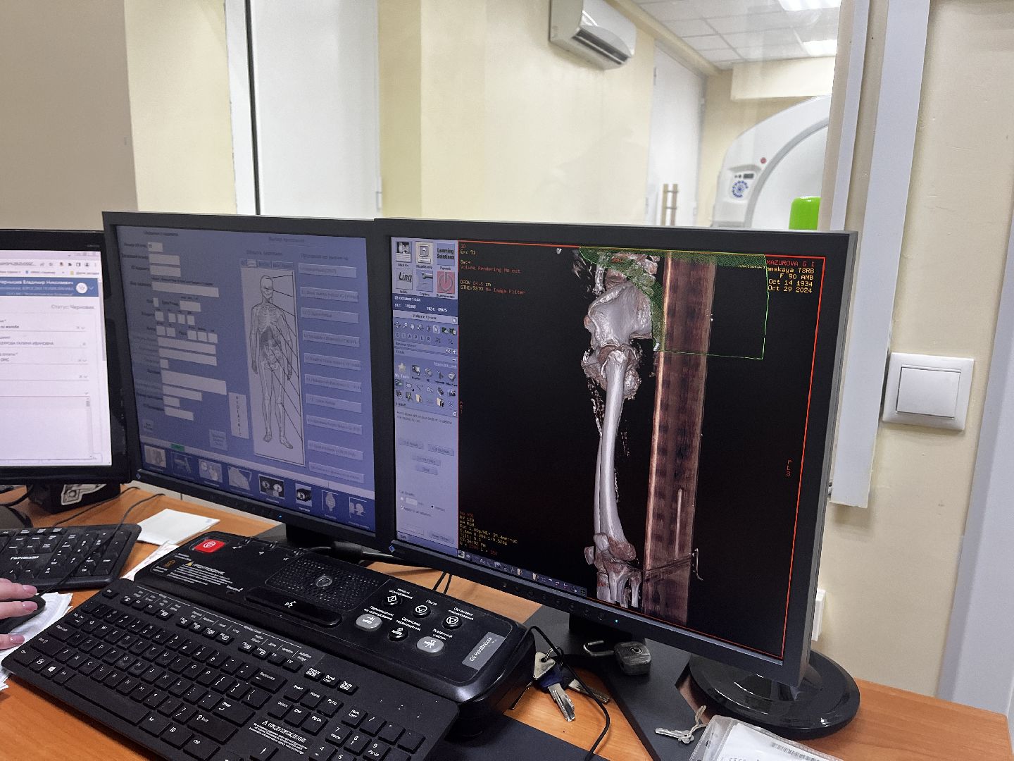 волоколамск, КТ, компьютерная томография, медицина,