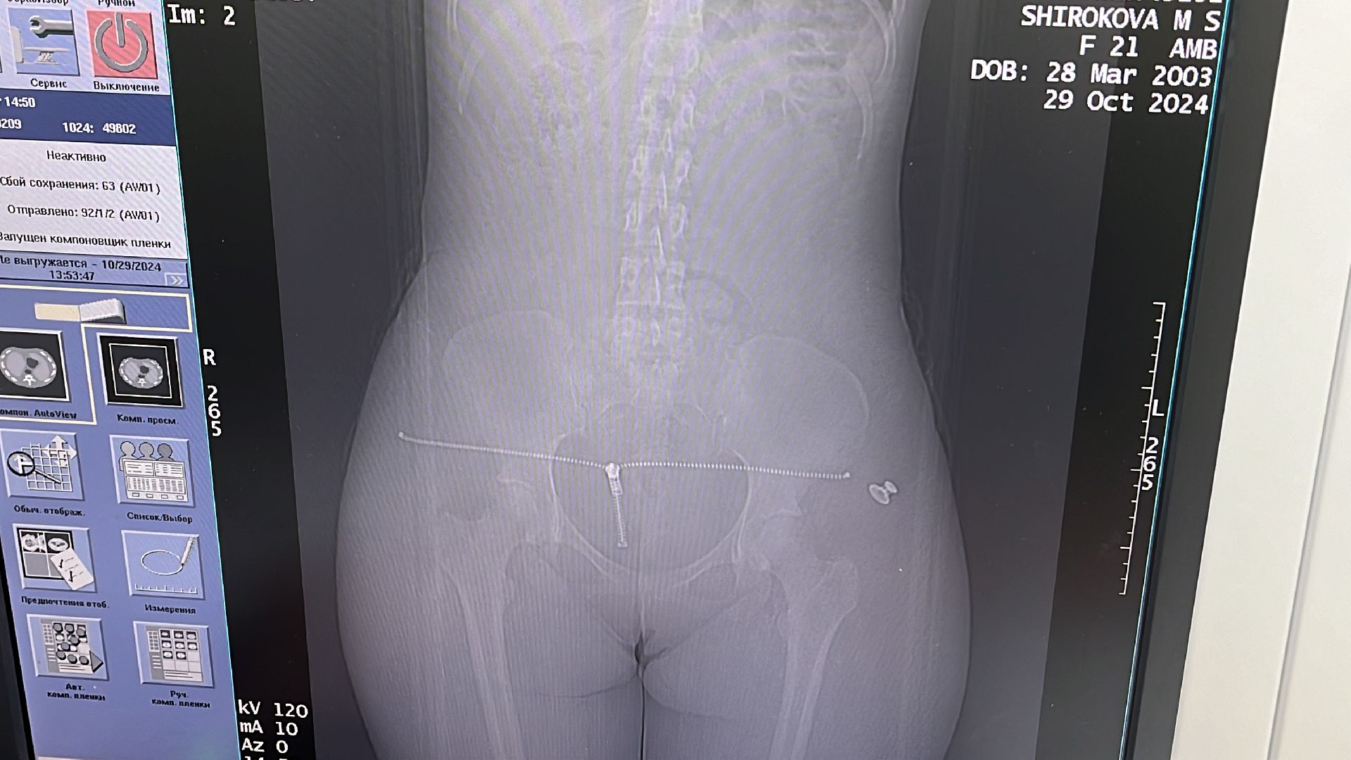 волоколамск, КТ, компьютерная томография, медицина,