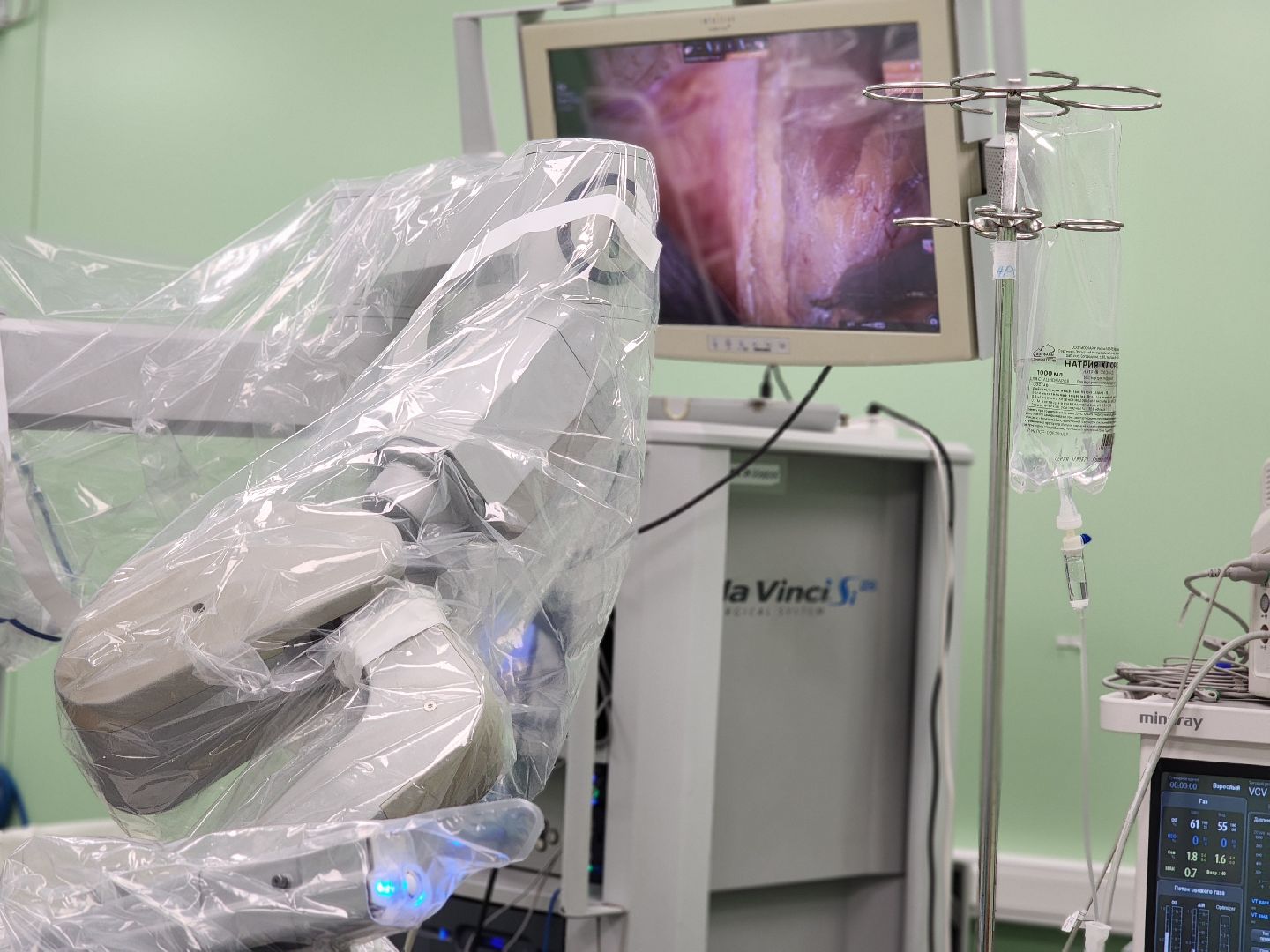 воскресенск, здравоохранение мо, операция, робот da vinci,