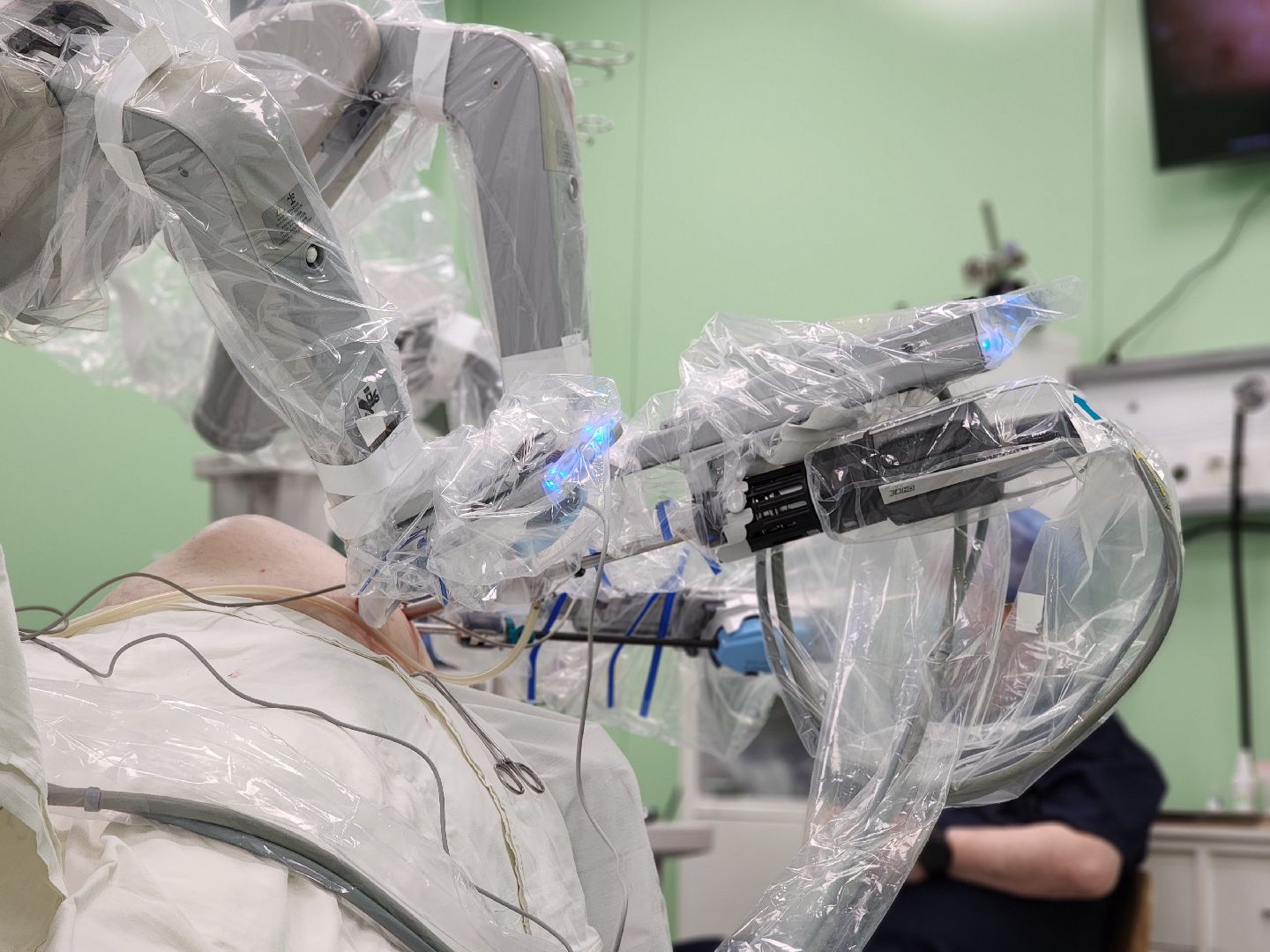 воскресенск, здравоохранение мо, операция, робот da vinci,