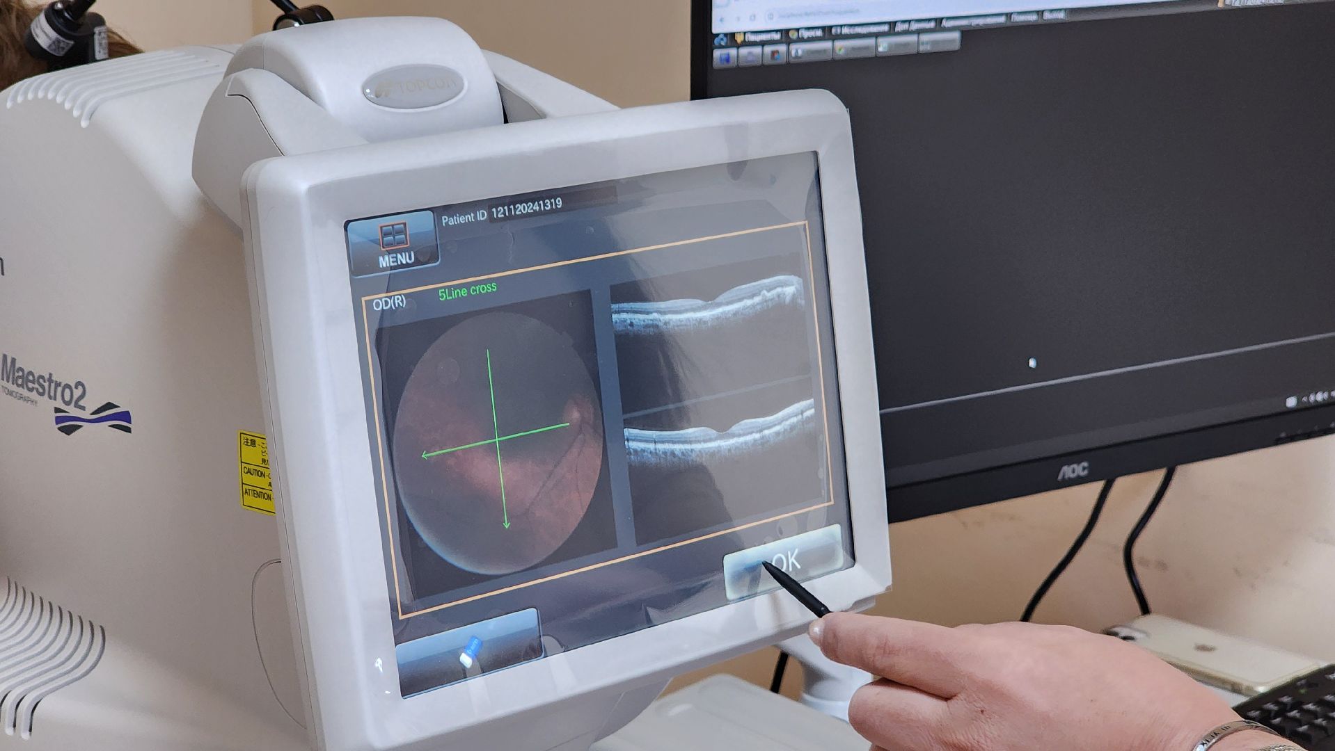 протвино, медициона, медицинское оборудование, поликлиника протвино, кабинет офтальмолога,