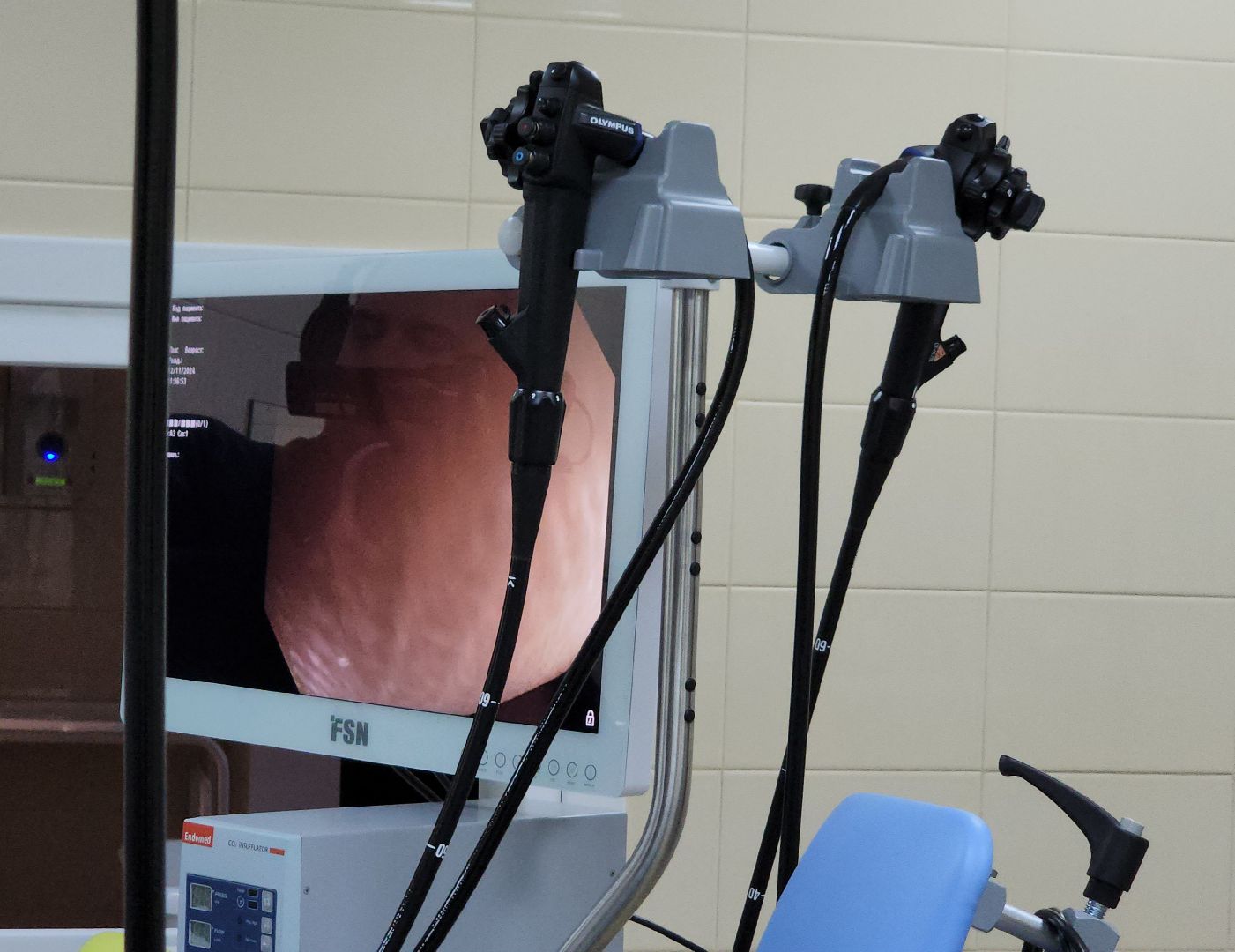 Дубна, дубненская больница, Эндоскопическое отделение, Новое оборудование,