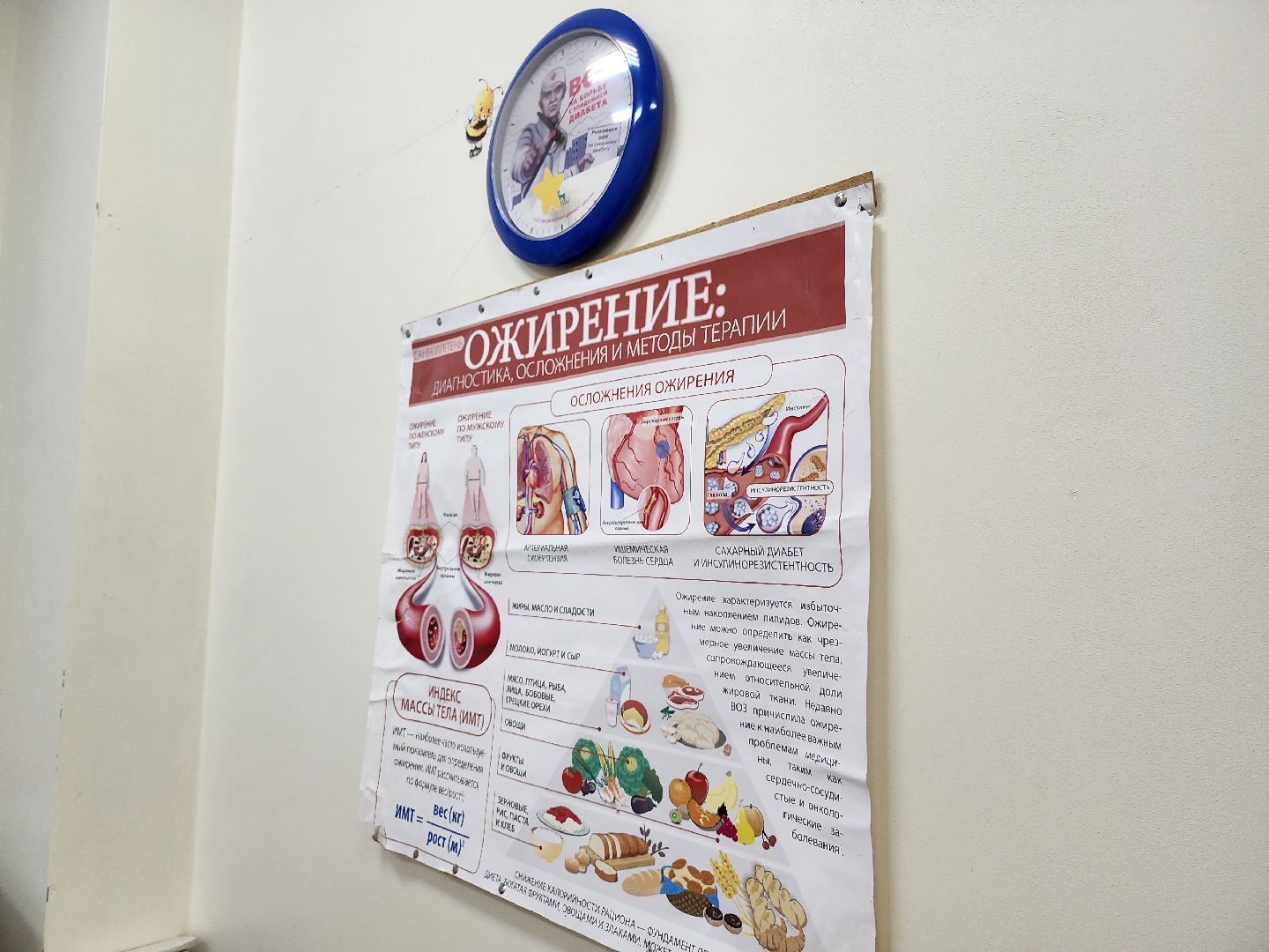 Дубна, дубненская больница, сахарный диабет, Профилактика, Врач-эндокринолог,