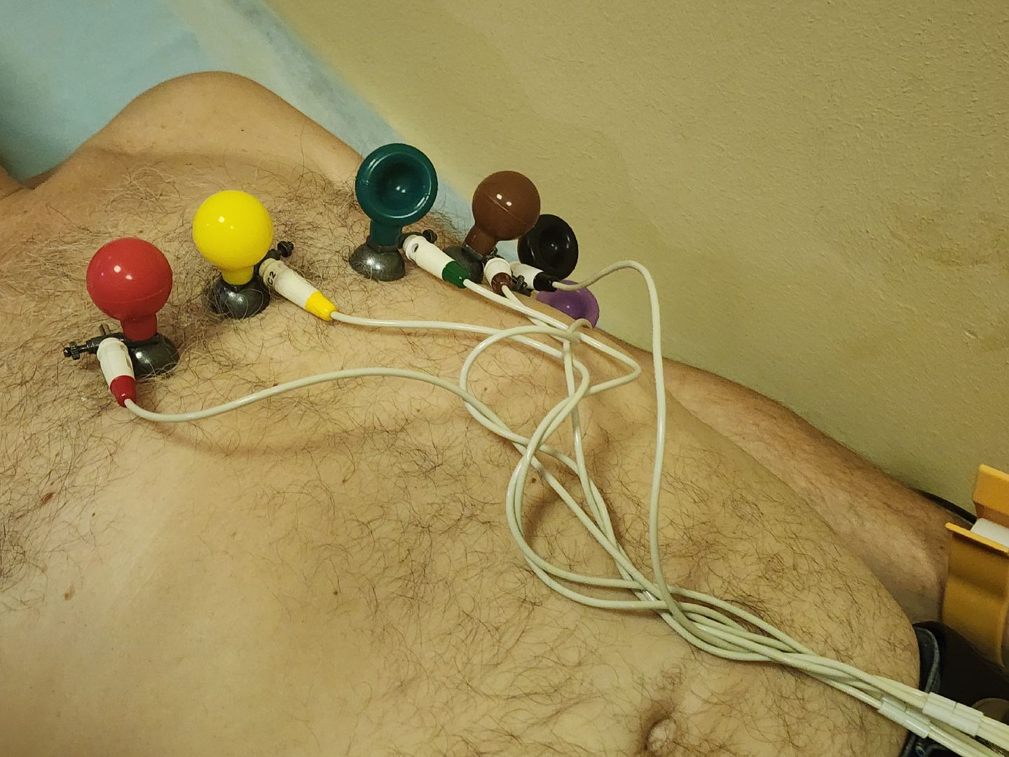 диспансеризация, обследование, здоровое сердце,