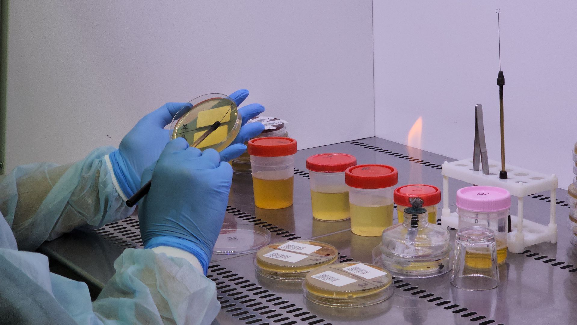 красногорск, больница, антимикробная резистентность, медицина,