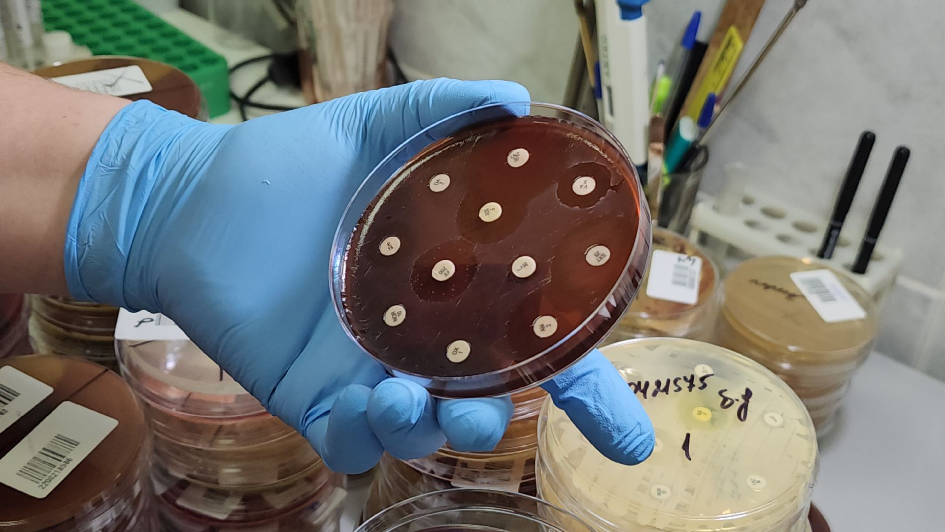 красногорск, больница, антимикробная резистентность, медицина,