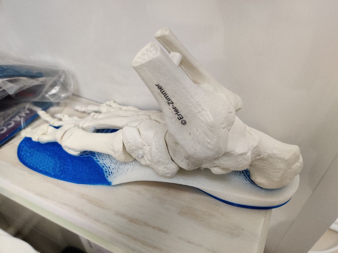 Красноармейск, Пушкинский, бизнес, ортезы для стоп, ортопедические стельки, здоровье