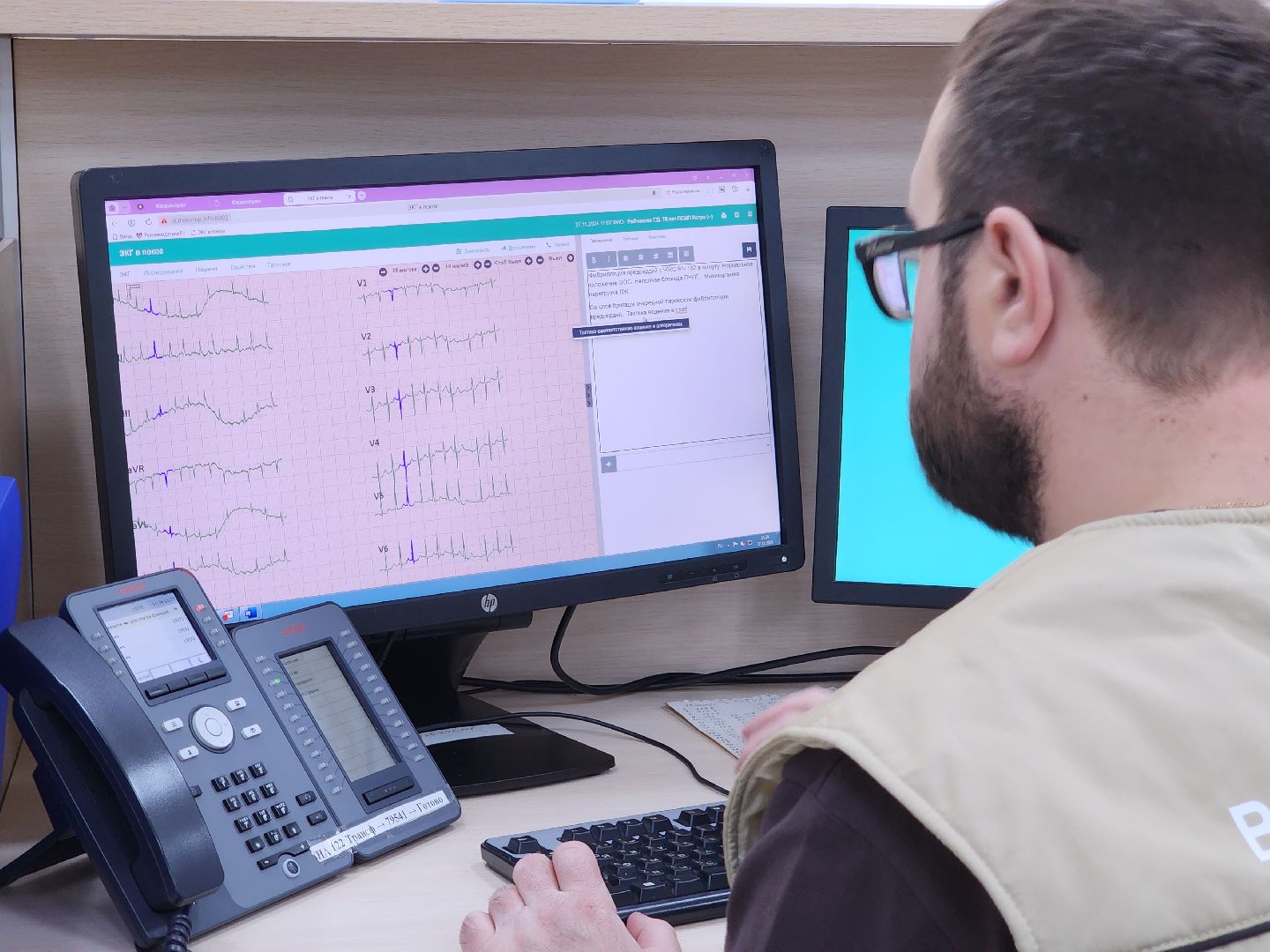 кардиопульт, кардиограмма, экг, скорая помощь, красногорск,