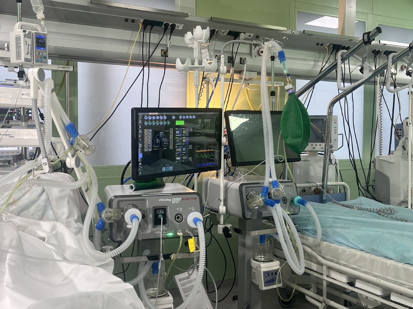 ивл, искусственная вентиляция легких, аппарат, новый аппарат, аппарат ивл,