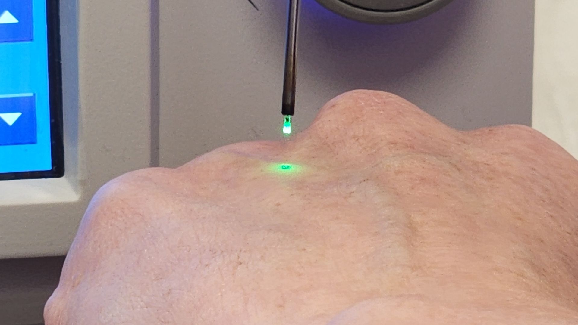 Солнечногорск, вертикалки, медицина, хирургия, бескровные операции,