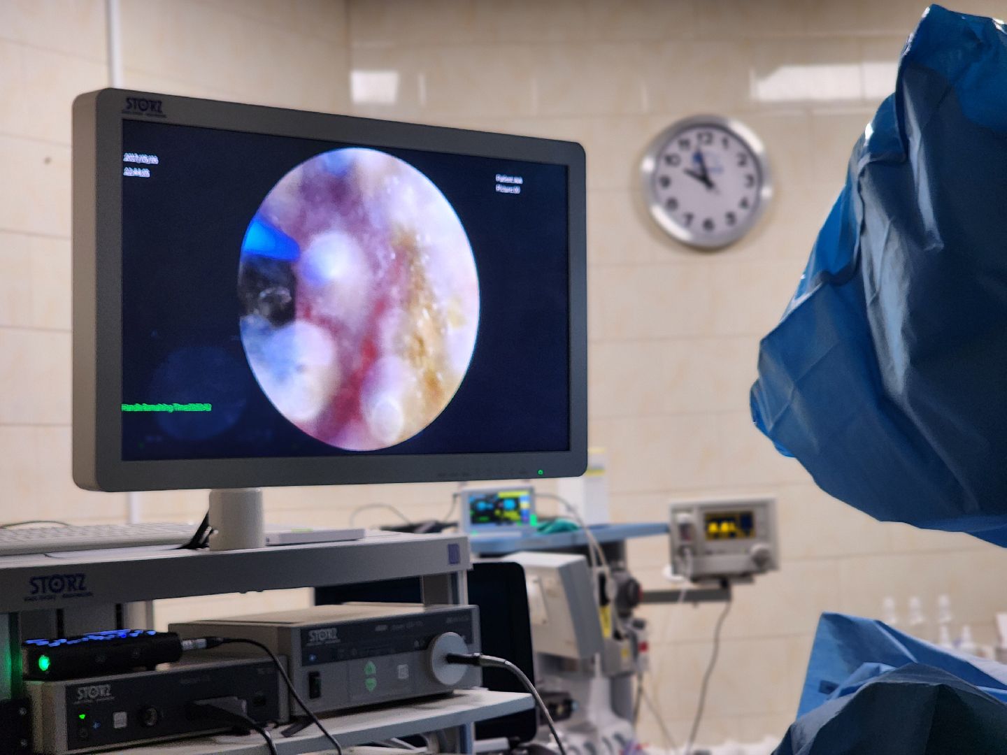 воскресенск, медицина, урология, операции,